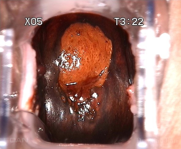 C6A acetic acid