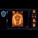 Smart Pelvic - Софтуер за ехограф Mindray