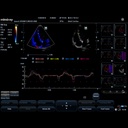 TDI QA - Софтуер за ехограф Mindray
