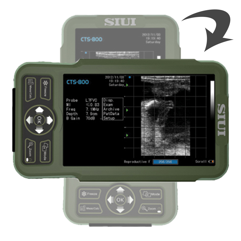 Ехограф SIUI CTS-800