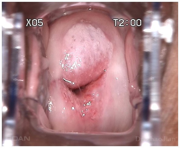C6A HD — резолюция