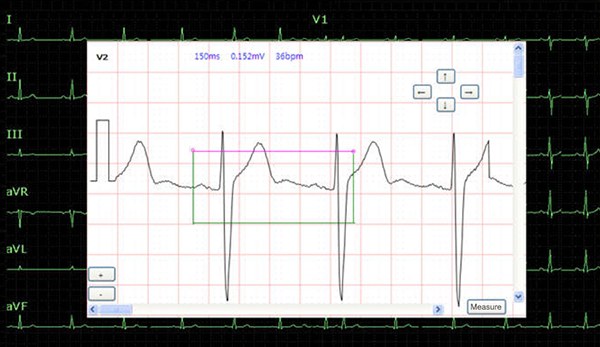 SE-1202 — measurements