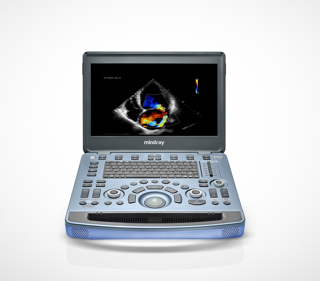 Vetus M11 view 3