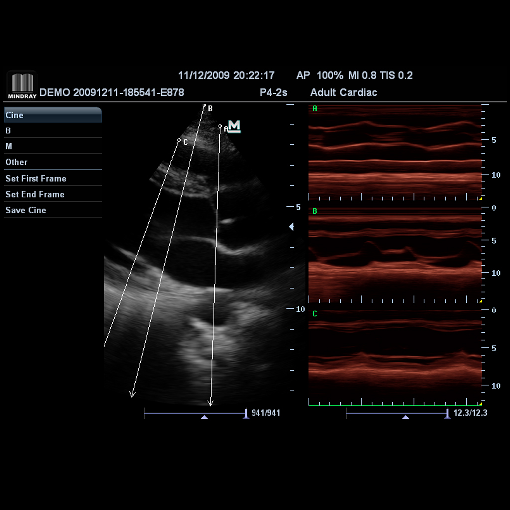 Free Xros M™ (Anatomical M-mode) - Софтуер за ехограф Mindray