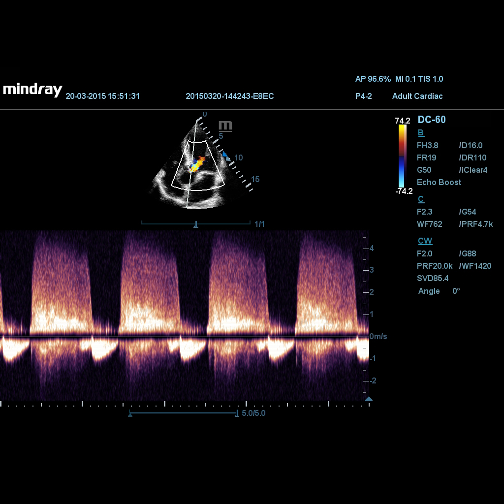 CW - Mindray Ultrasound Software