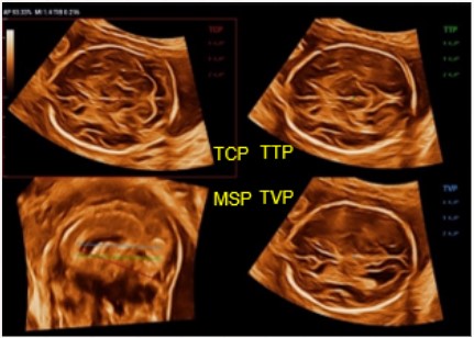 Smart Planes CNS - Софтуер за ехограф Mindray i10