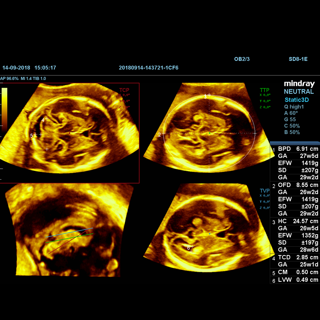 Smart Planes CNS - Софтуер за ехограф Mindray