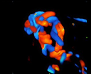 Color 3D - Софтуер за ехограф Mindray