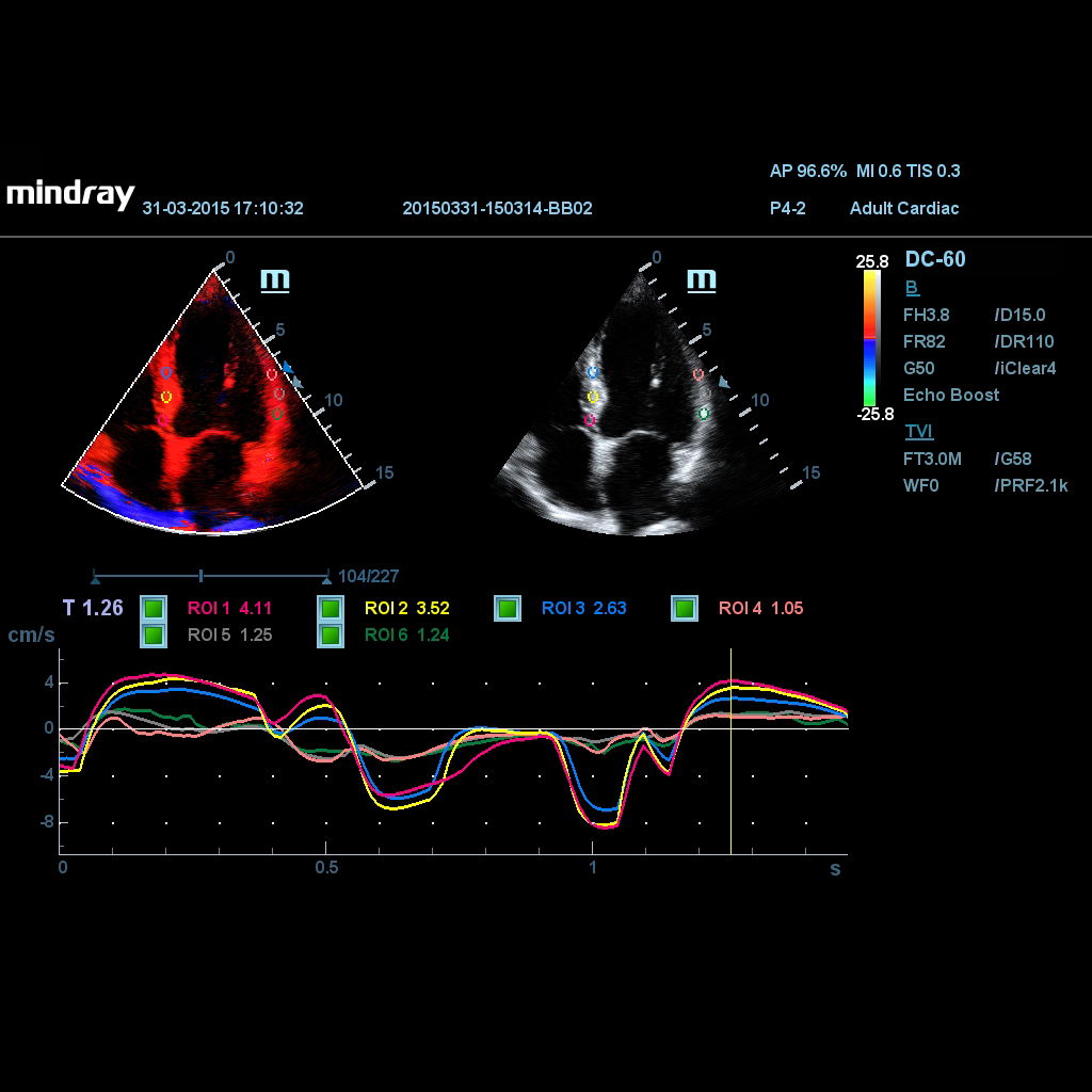 TDI QA - Mindray Ultrasound Software