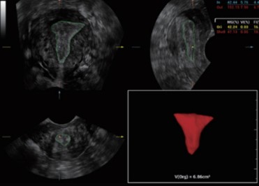 Smart V Trace - Софтуер за ехограф Mindray
