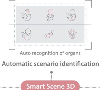 Smart Scene 3D - Софтуер за ехограф Mindray