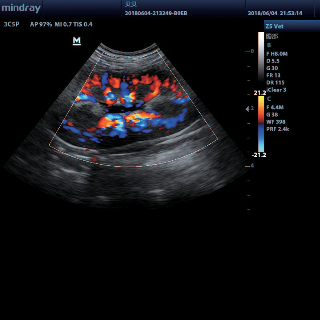 B/M/Color/Power/Directional Power Doppler Flow Imaging