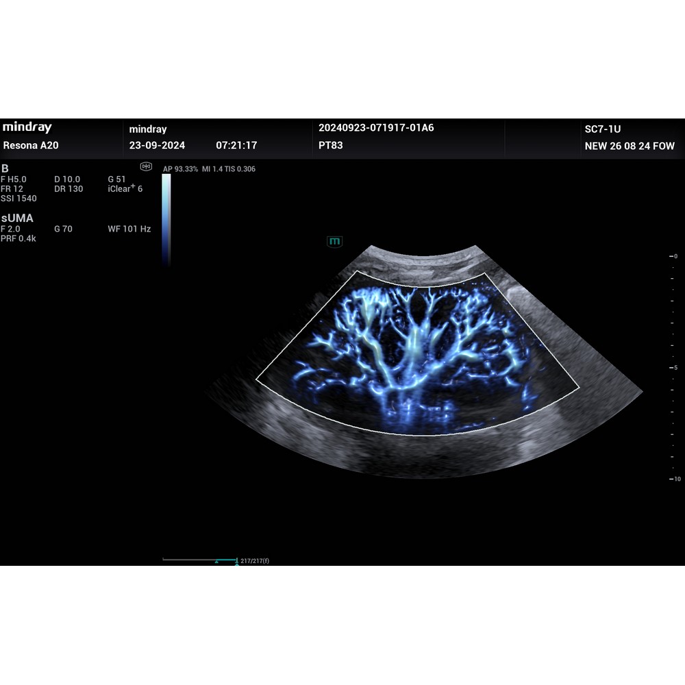 UMA - Софтуер за ехограф Mindray