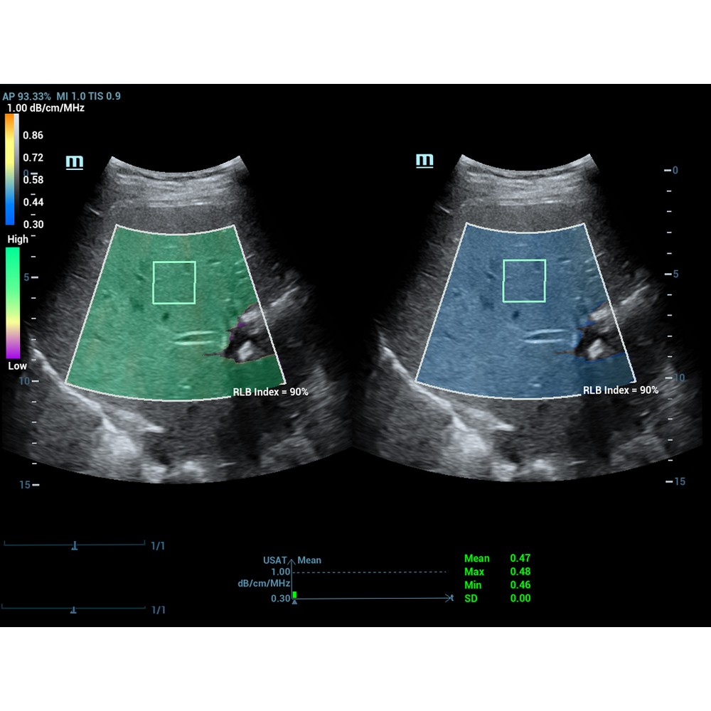 USAT - Софтуер за ехограф Mindray