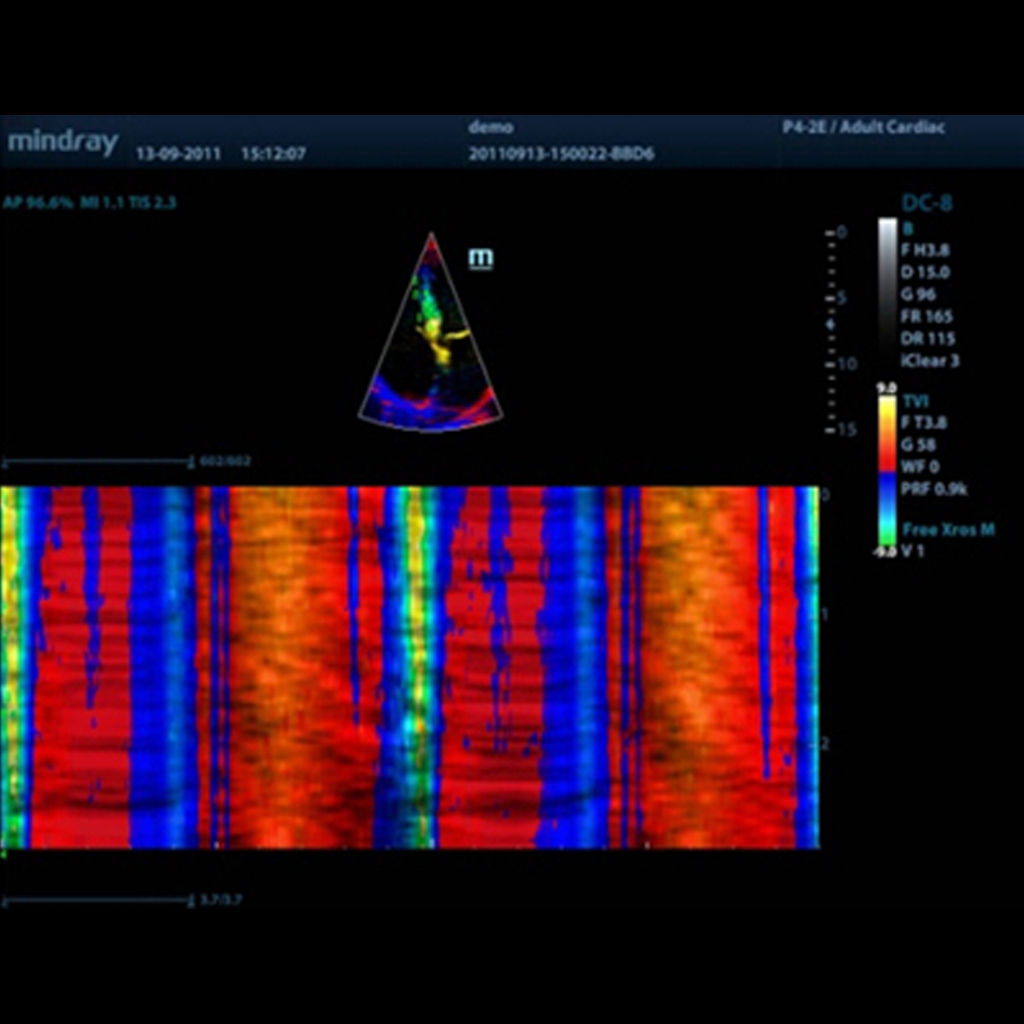 Free Xros CM - Mindray Veterinary Ultrasound Software