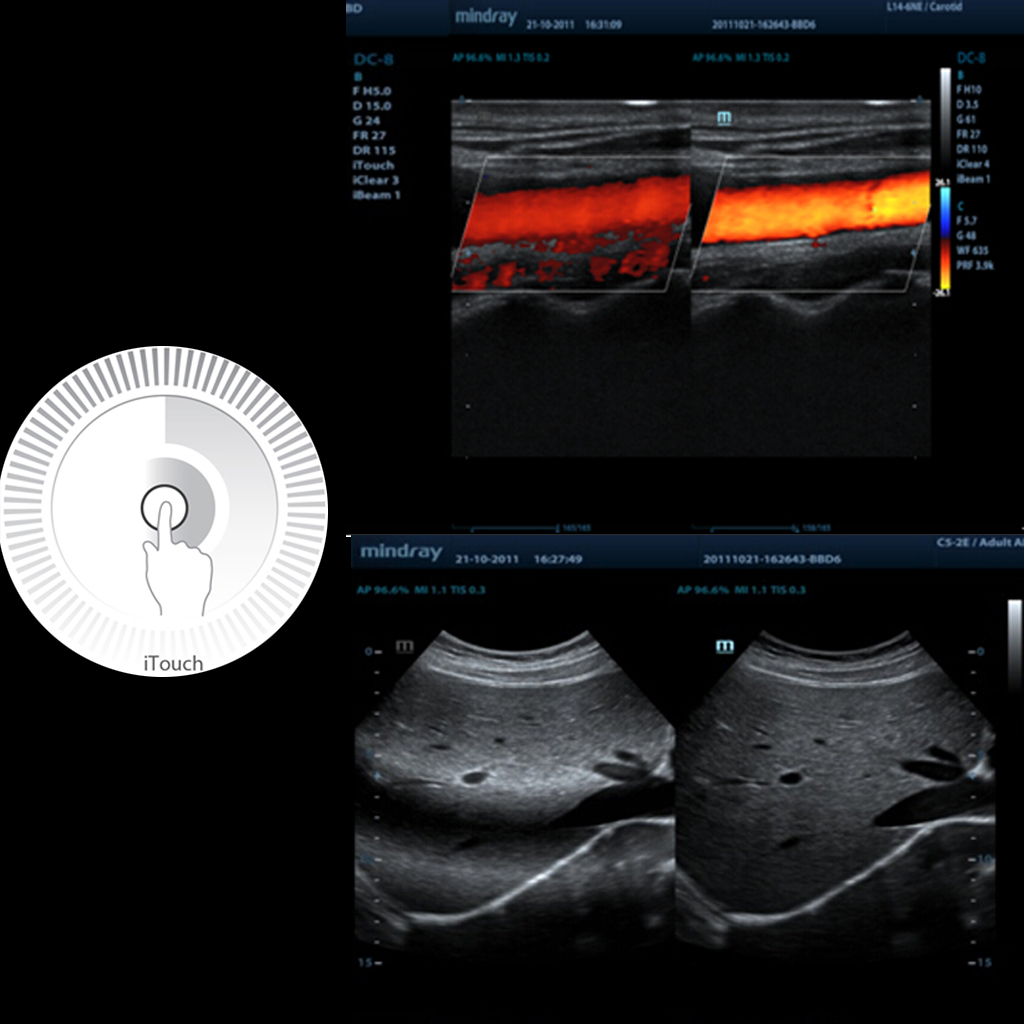 iTouch™ - Mindray Veterinary Ultrasound Software