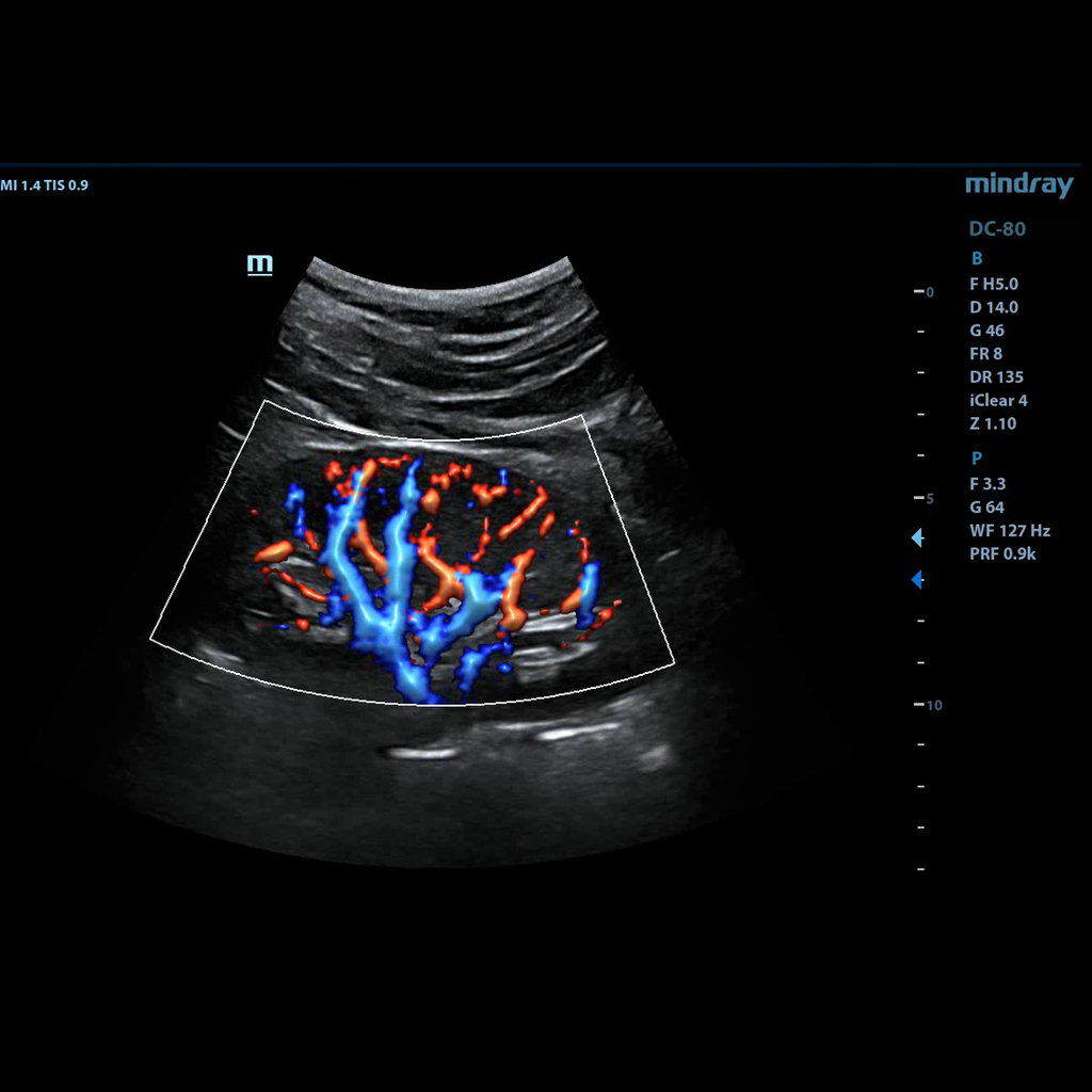 Glazing Flow - Mindray Veterinary Ultrasound Software