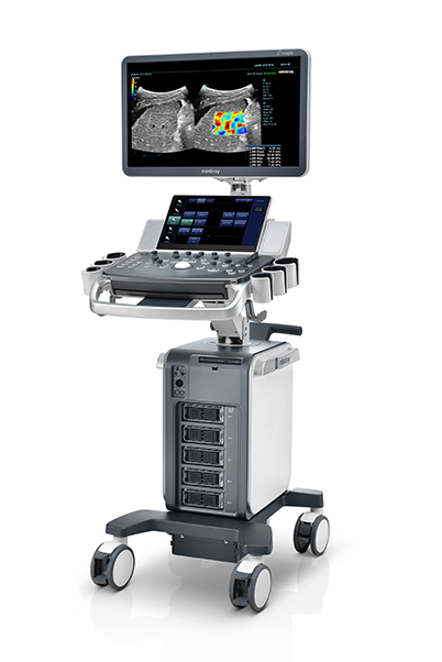 Стационарен ехограф DC-80A X-INSIGHT Mindray