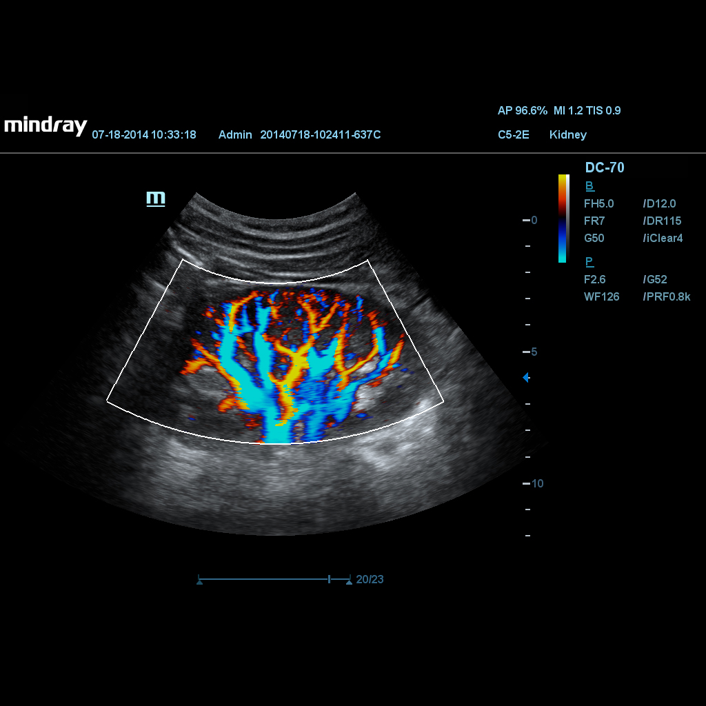 HR Flow™ (High Resolution Flow)