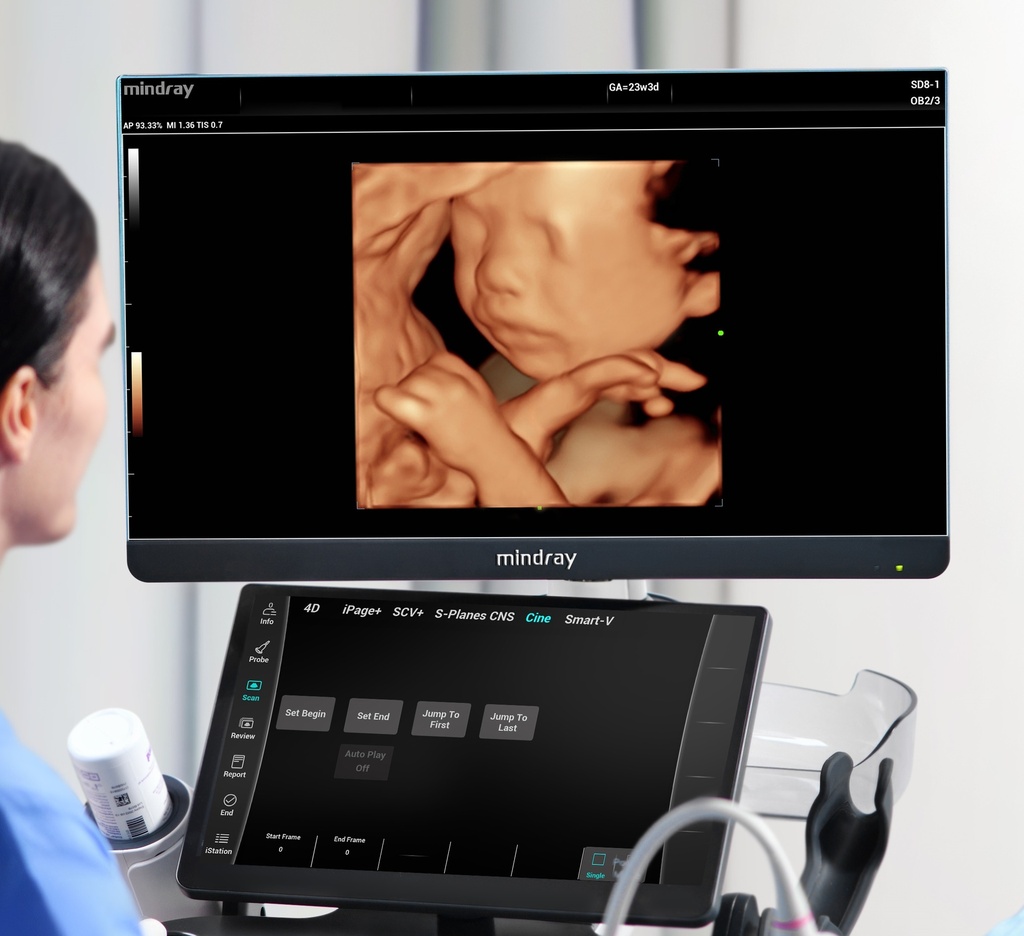 iZoom™ (Full Screen View)