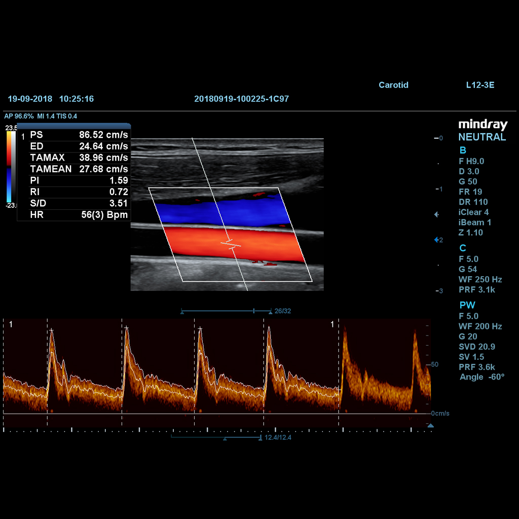 Smart Track (intelligent vessel tracking and image optimization)