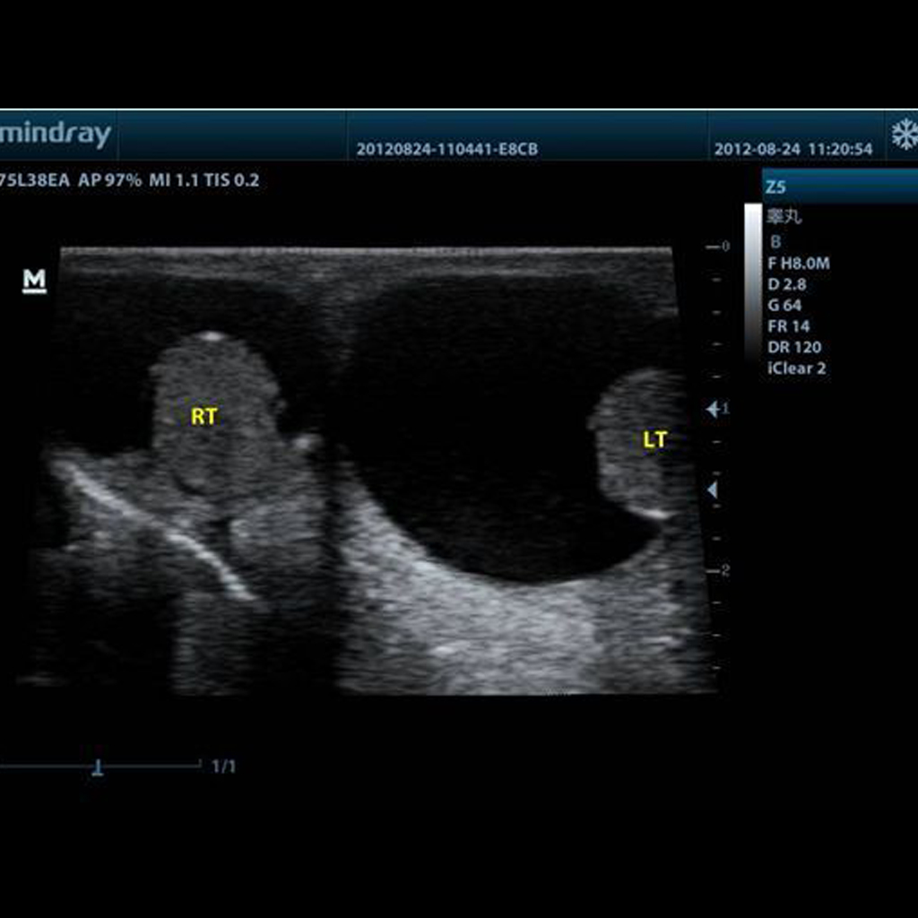 Trapezoid Imaging/ExFOV