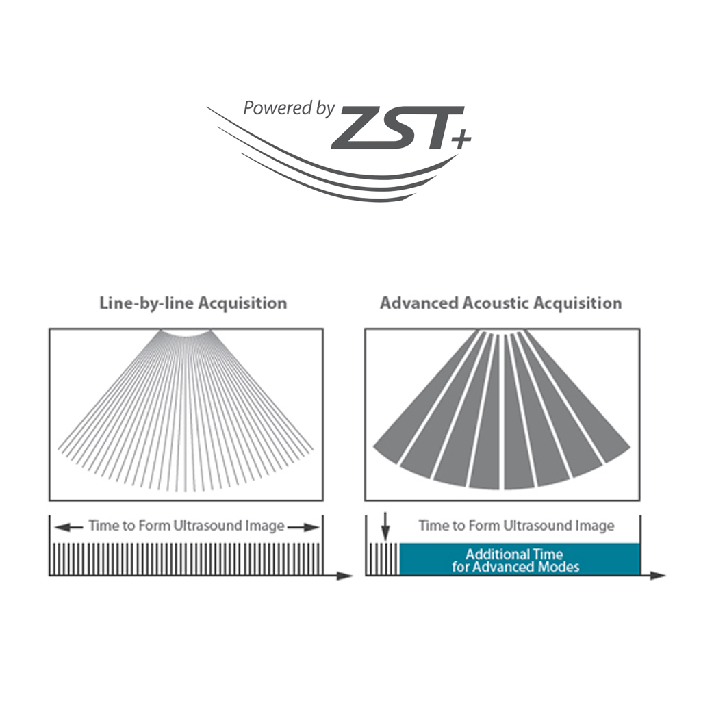 ZST+ Platform Mindray Software