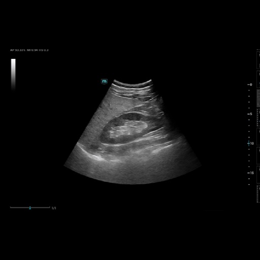 [119061732] Smart HRI - Софтуер за ехограф Mindray