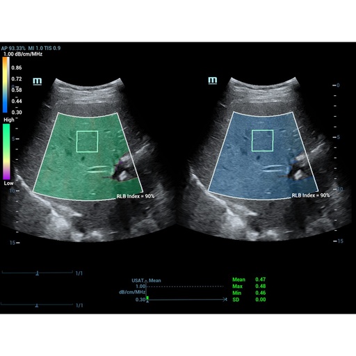 [119061857] USAT - Софтуер за ехограф Mindray