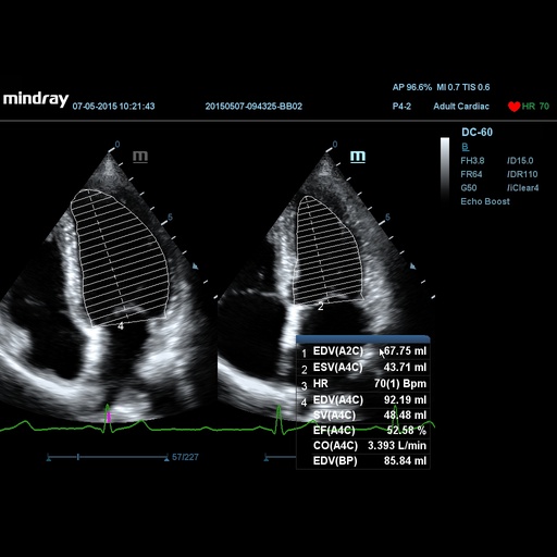 [1571500153] Auto EF - Mindray Veterinary Ultrasound Software