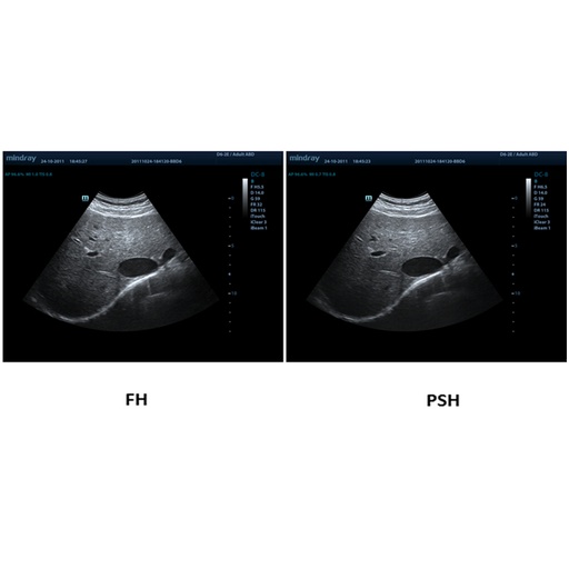 [1571500185] PSH™  - Софтуер за ветеринарен ехограф Mindray