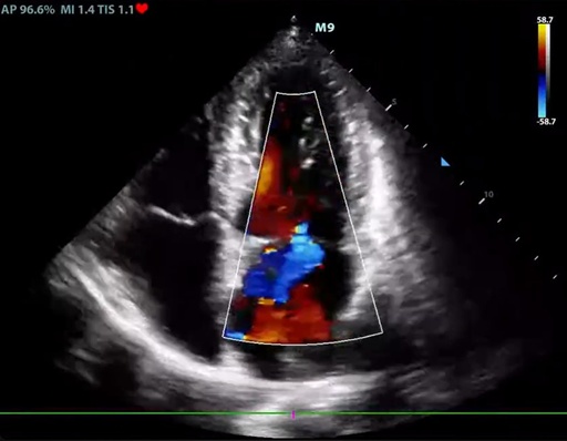 [11906662] HDR Flow (High Dynamic Range Flow)