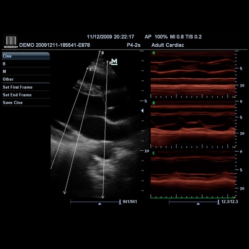 [119061670] Free Xros M™ (Anatomical M-mode) - Софтуер за ехограф Mindray