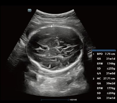 [119061678] Smart OB™ - Софтуер за ехограф Mindray