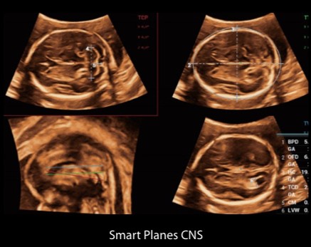 [119061699] Smart Planes CNS - Софтуер за ехограф Mindray