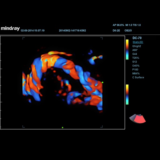 [119061703] Color 3D - Софтуер за ехограф Mindray