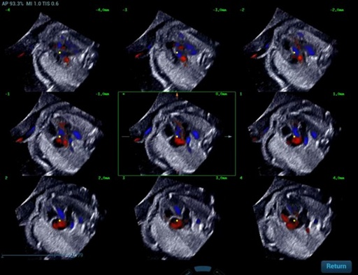 [119061704] STIC - Софтуер за ехограф Mindray
